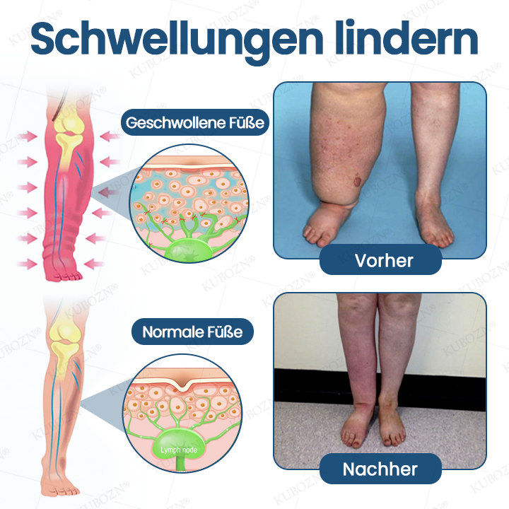 KUBOZN® DE | Offizieller EU-Shop — Lymph-Entlastungs-Roll-On – Klinisch inspirierte Lösung zur Reduzierung von Lymphschwellungen und zur Wiederherstellung eines gesunden Lymphflusses ⚕️
