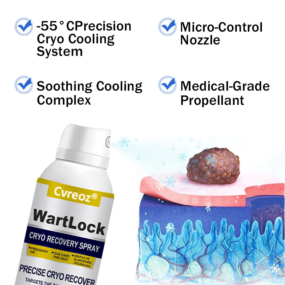 🎅 𝘾𝙝𝙧𝙞𝙨𝙩𝙢𝙖𝙨 𝙎𝙖𝙡𝙚 | Cvreoz® WartLock CRYO RECOVERY SPRAY