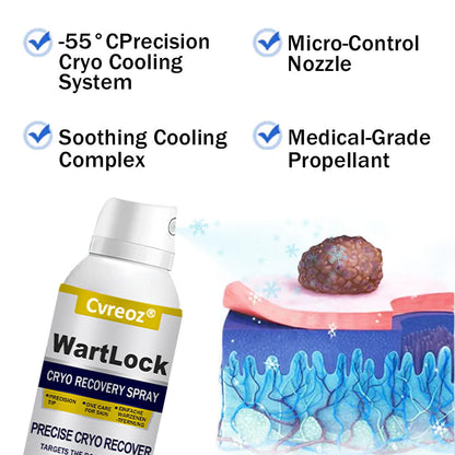 🎅 𝘾𝙝𝙧𝙞𝙨𝙩𝙢𝙖𝙨 𝙎𝙖𝙡𝙚 | Cvreoz® WartLock CRYO RECOVERY SPRAY