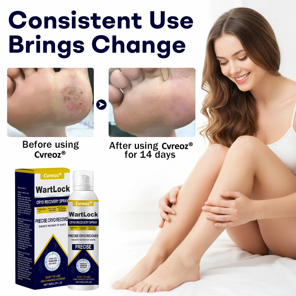 🎅 𝘾𝙝𝙧𝙞𝙨𝙩𝙢𝙖𝙨 𝙎𝙖𝙡𝙚 | Cvreoz® WartLock CRYO RECOVERY SPRAY