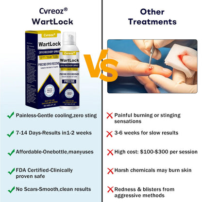 🎅 𝘾𝙝𝙧𝙞𝙨𝙩𝙢𝙖𝙨 𝙎𝙖𝙡𝙚 | Cvreoz® WartLock CRYO RECOVERY SPRAY