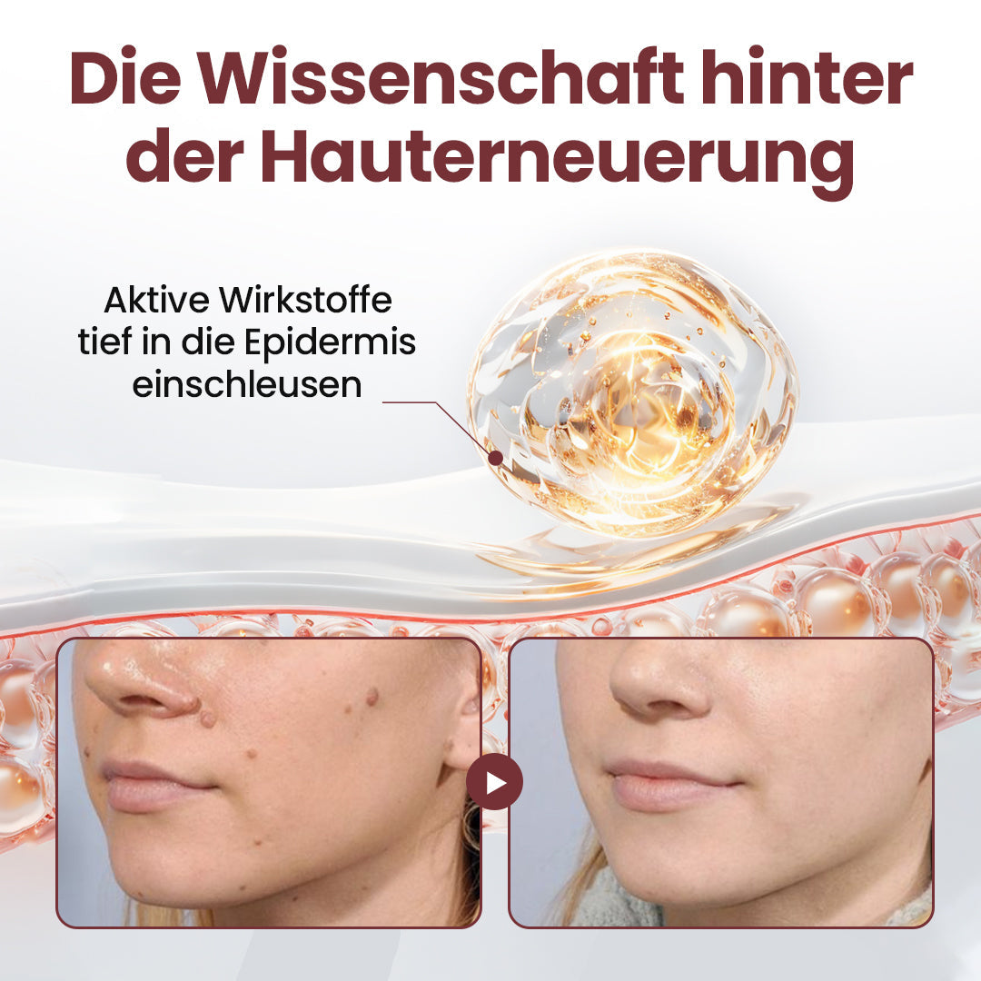 ⭐ Cvreoz® OryzaClear – Schwarzreis-Extrakt Creme gegen Hautanhänge & raue Stellen – sanft, pflanzlich & sichtbar wirksam