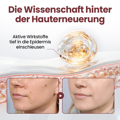 ⭐ Cvreoz® OryzaClear – Schwarzreis-Extrakt Creme gegen Hautanhänge & raue Stellen – sanft, pflanzlich & sichtbar wirksam