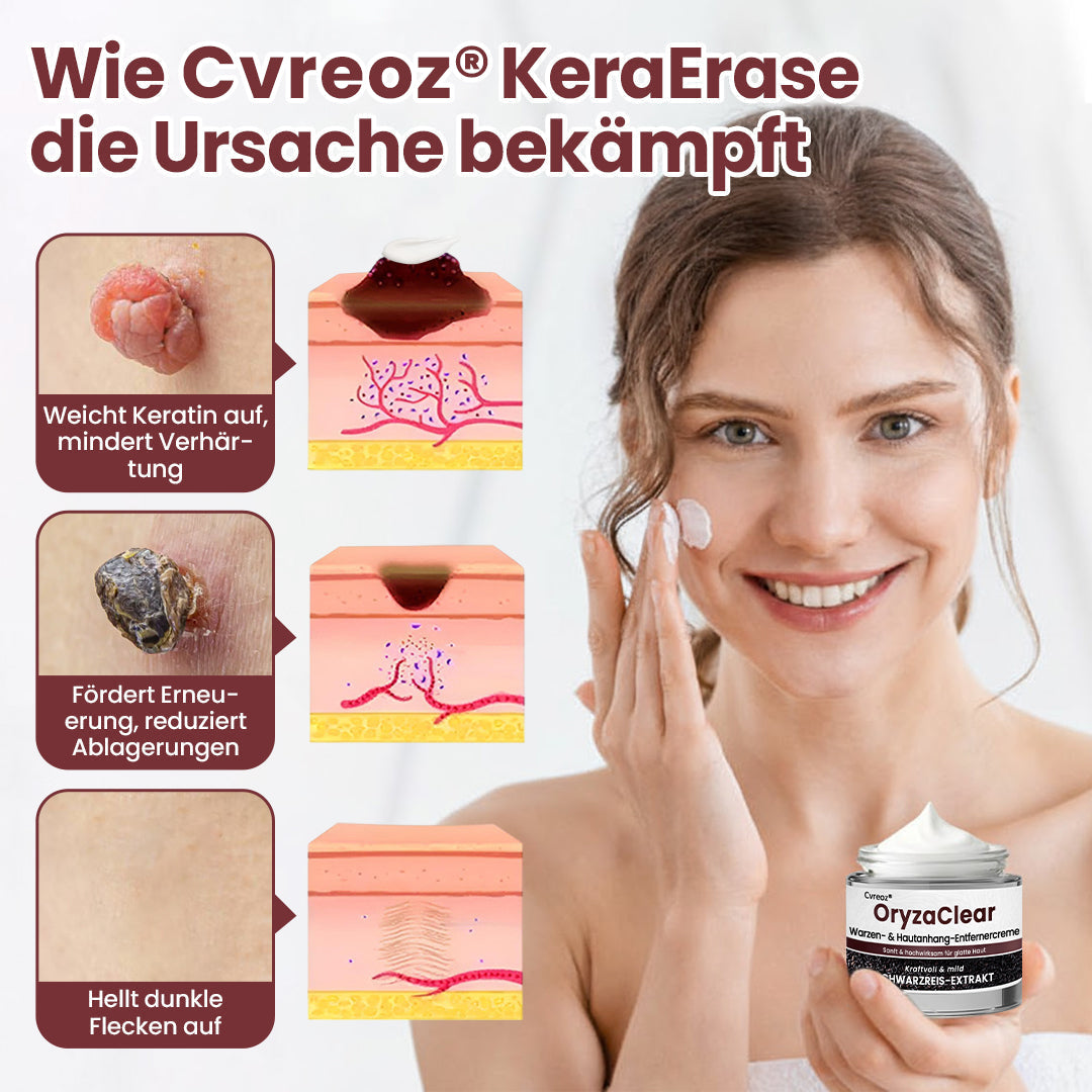 ⭐ Cvreoz® OryzaClear – Schwarzreis-Extrakt Creme gegen Hautanhänge & raue Stellen – sanft, pflanzlich & sichtbar wirksam