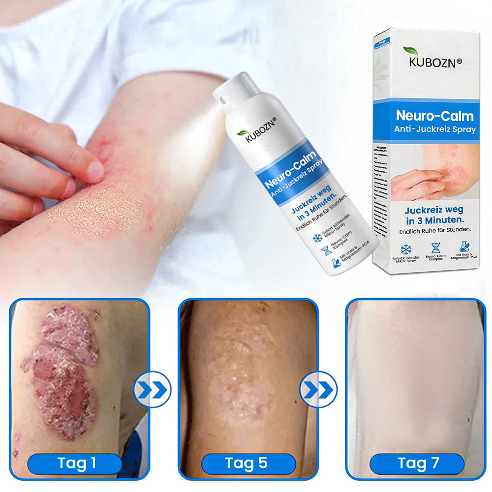 ✅KUBOZN® Magnesium Kräuter-Psoriasis Spray – TÜV Geprüft (Lindert Psoriasis & Ekzeme, verbessert bakterielle Hautinfektionen im Intimbereich, unterstützt bei Akne & Warzen) (Copy)