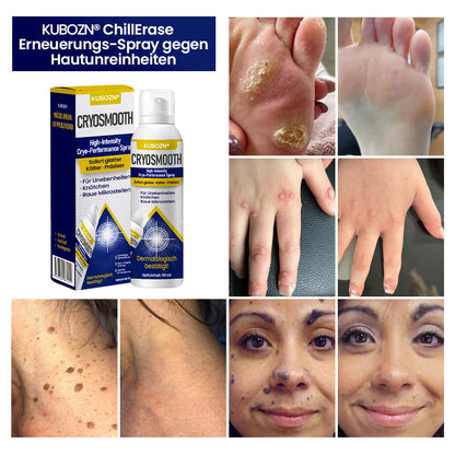 ⭐ KUBOZN® ChillErase – Präzisions-Pflegespray gegen Unebenheiten & kleine Hautknötchen