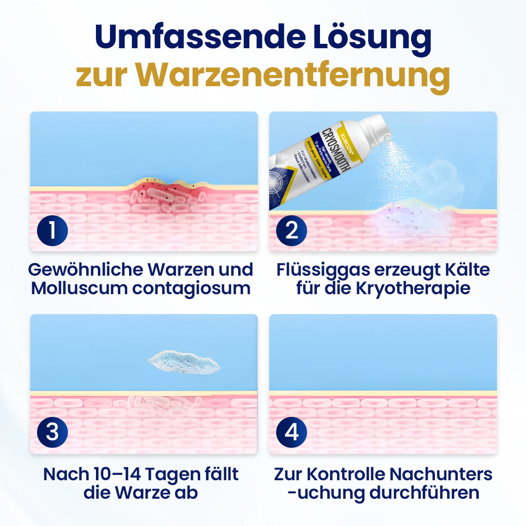 ⭐ KUBOZN® ChillErase – Präzisions-Pflegespray gegen Unebenheiten & kleine Hautknötchen