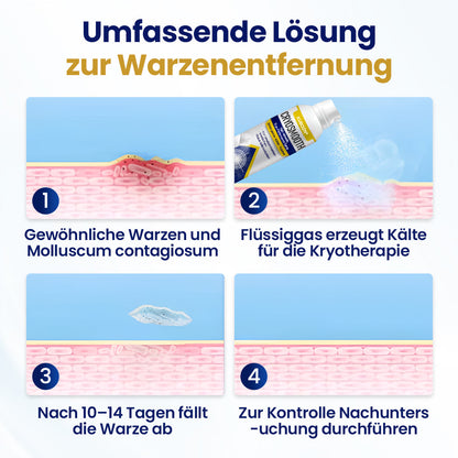 ⭐ KUBOZN® ChillErase – Präzisions-Pflegespray gegen Unebenheiten & kleine Hautknötchen