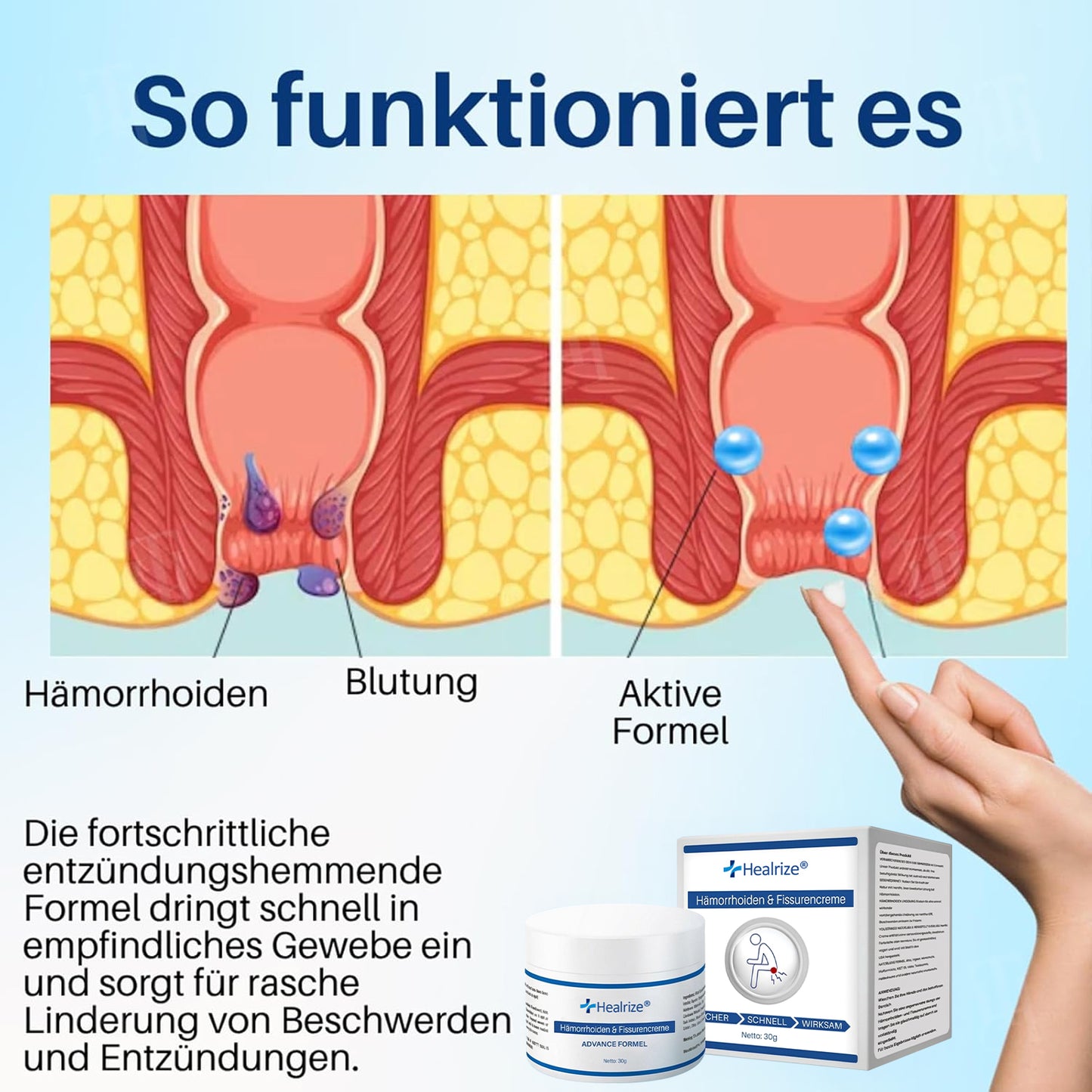 ✨ Neujahrs-Angebot | Healrize® Hämorrhoiden & Fissurencreme✨