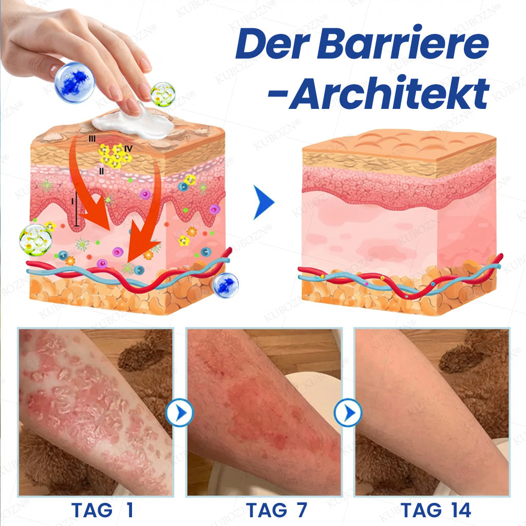KUBOZN® Psoriasis Tag & Nacht System – 100% steroidfrei gegen Schuppen & Plaque (offer)