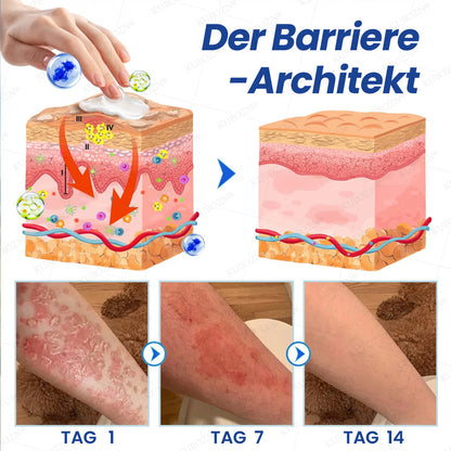 KUBOZN® Psoriasis Tag & Nacht System – 100% steroidfrei gegen Schuppen & Plaque (offer)