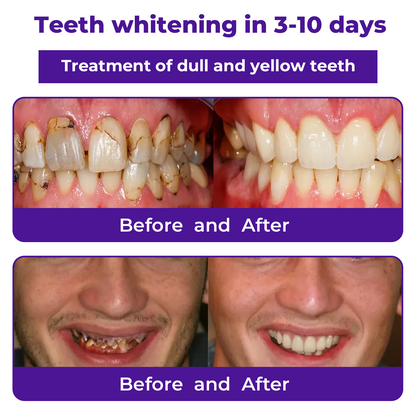 🦷Cvreoz® Dental Repair Mineral Powder >> 🔥Buy 1 Get 1 Free🔥
