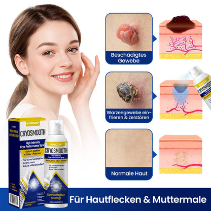 ⭐ KUBOZN® ChillErase – Präzisions-Pflegespray gegen Unebenheiten & kleine Hautknötchen