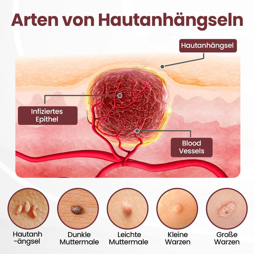 ⭐ Cvreoz® OryzaClear – Schwarzreis-Extrakt Creme gegen Hautanhänge & raue Stellen – sanft, pflanzlich & sichtbar wirksam