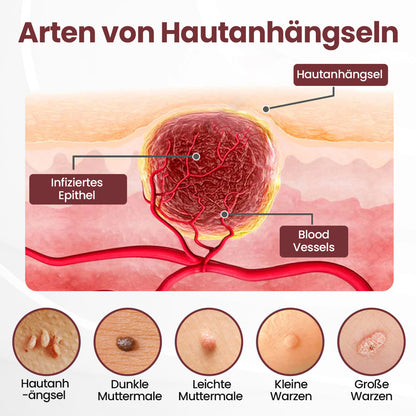 ⭐ Cvreoz® OryzaClear – Schwarzreis-Extrakt Creme gegen Hautanhänge & raue Stellen – sanft, pflanzlich & sichtbar wirksam