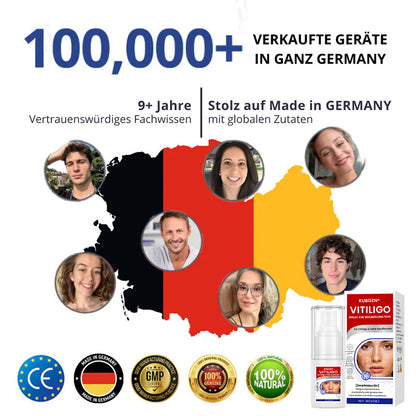 Kubozn® Spray gegen Vitiligo — Dermatologisch getestet, pflanzlich & steroidfrei (Offer)