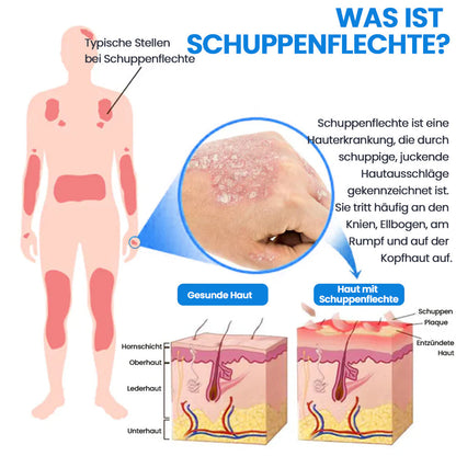 ✅KUBOZN® Magnesium Kräuter-Psoriasis Spray – TÜV Geprüft (Lindert Psoriasis & Ekzeme, verbessert bakterielle Hautinfektionen im Intimbereich, unterstützt bei Akne & Warzen) (Copy)
